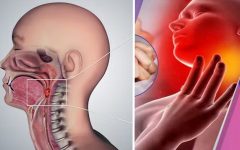 Experts Sound Alarm as Oral Sex Surpasses Smoking as Leading Cause of Throat Cancer